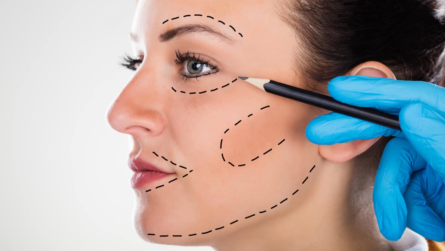 How Facelift Treatment Can Fix Facial Asymmetry