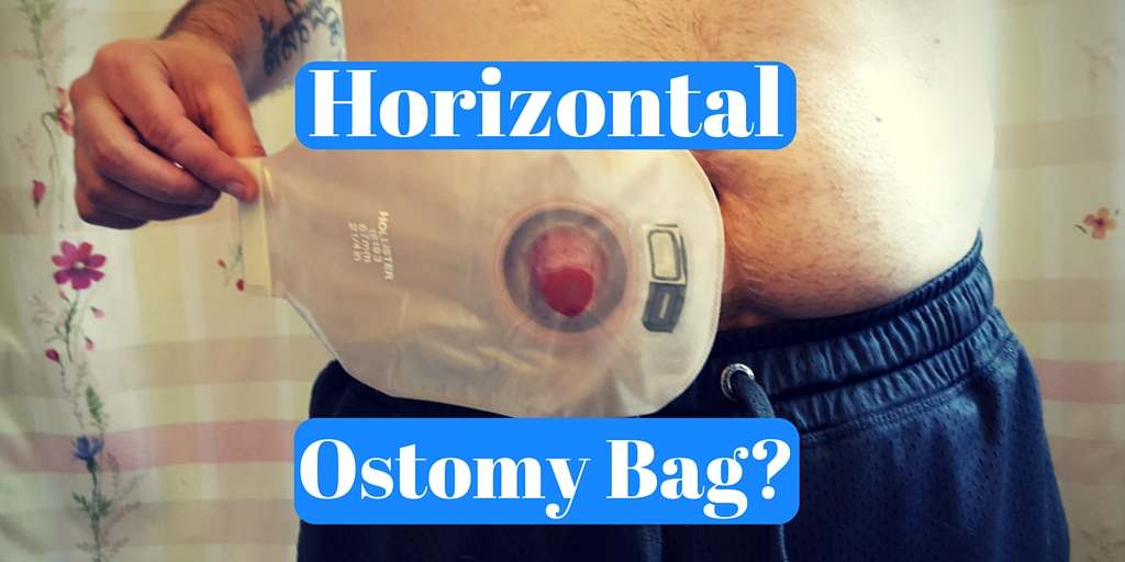 Try These Amazing Hacks to Conceal Your Ostomy Bag